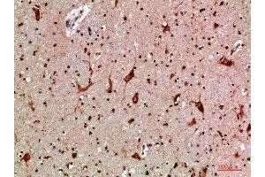 Immunohistochemical analysis of paraffin-embedded human-brain, antibody was diluted at 1:200 (MBL2 anticorps  (AA 21-70))