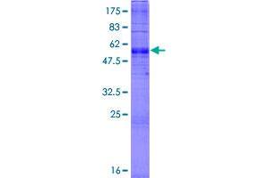 Image no. 1 for CMP-Sialic Acid Transporter (CMPST) (AA 1-337) protein (GST tag) (ABIN1320380)