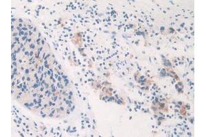 Used in DAB staining on fromalin fixed paraffin- embedded prostate gland cancer tissue (GALC anticorps  (AA 375-535))