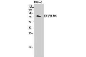 Western Blotting (WB) image for anti-Proto-oncogene tyrosine-protein kinase Src (Src) (Tyr1161) antibody (ABIN3174585) (Src anticorps  (Tyr1161))
