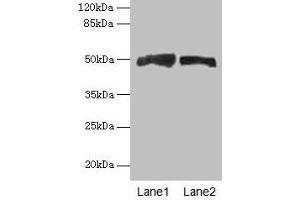 Western blot All lanes: AZIN1 antibody at 4 μg/mL Lane 1: Mouse liver tissue Lane 2: PC-3 whole cell lysate Secondary Goat polyclonal to rabbit IgG at 1/10000 dilution Predicted band size: 50 kDa Observed band size: 50 kDa (Antizyme Inhibitor 1 anticorps  (AA 101-400))