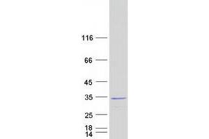 Syndecan Binding Protein (Syntenin) (SDCBP) (Transcript Variant 1) protein (Myc-DYKDDDDK Tag)