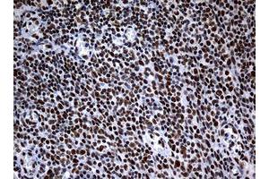 Image no. 7 for anti-Nibrin (NBN) (AA 461-754) antibody (ABIN1491540)