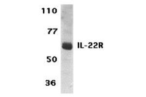 Western Blotting (WB) image for anti-Interleukin 22 Receptor (IL22R) (C-Term) antibody (ABIN1030435) (IL22R anticorps  (C-Term))