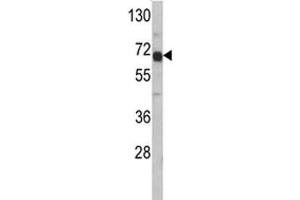 Western blot analysis of AFP antibody and HepG2 lysate.