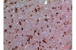 Immunohistochemistry (IHC) analysis of paraffin-embedded Rat Brain, antibody was diluted at 1:100.