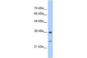 GSTZ1 antibody used at 2. (GSTZ1 anticorps)