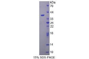SDS-PAGE analysis of Human TAF2 Protein.