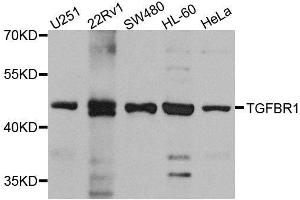 Western blot analysis of extracts of various cell lines, using TGFBR1 antibody. (TGFBR1 anticorps  (AA 34-124))