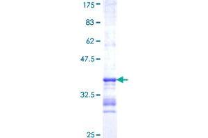 Image no. 1 for 5-Hydroxytryptamine (serotonin) Receptor 1F (HTR1F) (AA 203-279) protein (GST tag) (ABIN1307267)