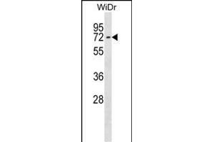 CTNNBL1 Antibody (N-term) (ABIN1539081 and ABIN2848704) western blot analysis in WiDr cell line lysates (35 μg/lane). (CTNNBL1 anticorps  (N-Term))
