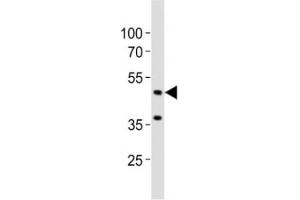 Western blot analysis of lysate from mouse brain tissue lysate using Eed antibody diluted at 1:1000.