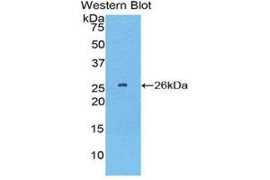Western Blotting (WB) image for anti-Tubulin Polymerization Promoting Protein (Tppp) (AA 8-210) antibody (ABIN1860848) (Tppp anticorps  (AA 8-210))