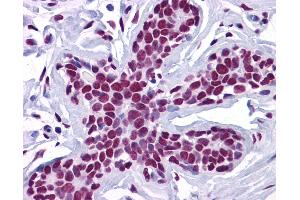 Anti-ZSCAN4 antibody IHC of human breast. (ZSCAN4 anticorps  (C-Term))