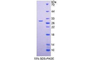 Image no. 1 for Solute Carrier Family 12 (Potassium-Chloride Transporter) Member 7 (SLC12A7) (AA 845-1056) protein (T7 tag,His tag) (ABIN6236769)