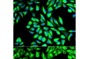 Immunofluorescence analysis of HeLa cells using EEF1A1 Polyclonal Antibody (eEF1A1 anticorps)