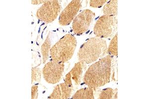 Immunohistochemical analysis of paraffin-embedded H. (CARD6 anticorps)