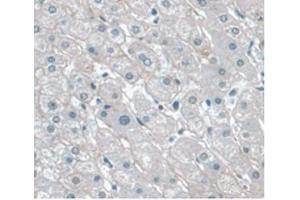 Detection of APOA1 in Human Liver Tissue using Monoclonal Antibody to Apolipoprotein A1 (APOA1)