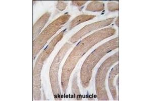 Formalin-fixed and paraffin-embedded human skeletal muscle tissue reacted with G4D Antibody  1811i , which was peroxidase-conjugated to the secondary antibody, followed by DAB staining.