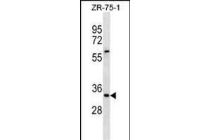 ING2 Antibody (Center) (ABIN1881460 and ABIN2838392) western blot analysis in ZR-75-1 cell line lysates (35 μg/lane). (ING2 anticorps  (AA 112-141))