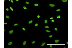 Immunofluorescence of monoclonal antibody to HDGFRP3 on HeLa cell.