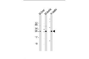 Lane 1: mouse liver lysates, Lane 2: mouse testis lysates, Lane 3: human testis lysates, probed with CDX1 (937CT11. (CDX1 anticorps)