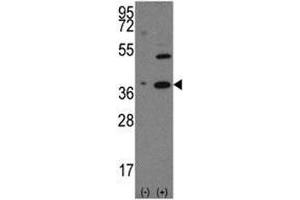 Western blot analysis of NANOG antibody and 293 cell lysate (2 ug/lane) either nontransfected (Lane 1) or transiently transfected with the human gene (2).