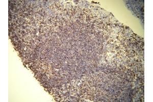 Immunohistochemistry (IHC) image for anti-Protein tyrosine Phosphatase, Receptor Type, C (PTPRC) (AA 1277-1292), (C-Term) antibody (ABIN870386)