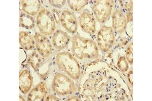 Immunohistochemistry of paraffin-embedded human kidney tissue using ABIN7174174 at dilution of 1:100 (PRPF4 anticorps  (AA 1-260))