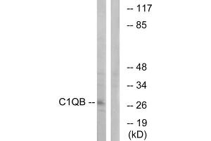 Western blot analysis of extracts from Jurkat cells, using C1QB antibody. (C1QB anticorps  (C-Term))