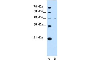 WB Suggested Anti-SLC16A1 Antibody Titration:  2. (SLC16A1 anticorps  (Middle Region))
