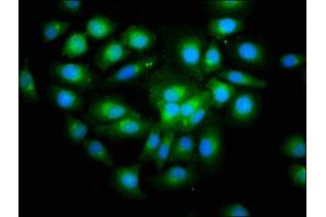 Immunofluorescence staining of A549 cells with ABIN7166112 at 1:200, counter-stained with DAPI. (SHISA5 anticorps  (AA 56-137))
