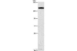 Western blot analysis of A431 cell, using ITGA2 Polyclonal Antibody at dilution of 1:300