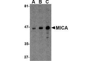 Western Blotting (WB) image for anti-MHC Class I Polypeptide-Related Sequence A (MICA) (C-Term) antibody (ABIN1030519) (MICA anticorps  (C-Term))