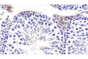 Detection of PIIINP in Mouse Testis Tissue using Polyclonal Antibody to Procollagen III N-Terminal Propeptide (PIIINP)