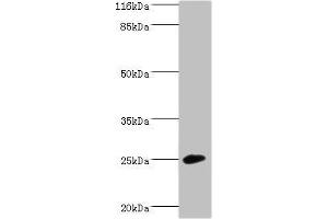 Western blot All lanes: CALN1 antibody at 2 μg/mL + Mouse brain tissue Secondary Goat polyclonal to rabbit IgG at 1/10000 dilution Predicted band size: 25, 30 kDa Observed band size: 25 kDa