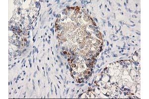 Immunohistochemistry (IHC) image for anti-Monoglyceride Lipase (MGLL) antibody (ABIN1499440) (MGLL anticorps)