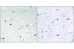 Immunohistochemistry analysis of paraffin-embedded human brain tissue, using Retinoblastoma (Ab-826) Antibody. (Retinoblastoma Protein (Rb) anticorps  (AA 601-650))