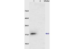 Lane 1: mouse testis lysates Lane 2: mouse lung lysates probed with Anti CTAG1B/Cancer/testis antigen 1 Polyclonal Antibody, Unconjugated (ABIN1385261) at 1:200 in 4 °C.