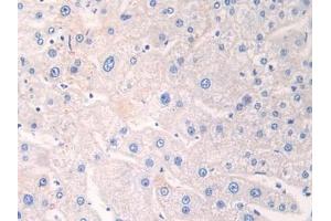 Detection of ADRP in Human Liver Tissue using Polyclonal Antibody to Adipose Differentiation Related Protein (ADRP)