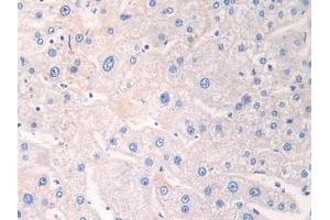Detection of ADRP in Human Liver Tissue using Polyclonal Antibody to Adipose Differentiation Related Protein (ADRP) (ADRP anticorps  (AA 245-433))