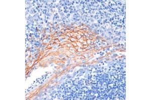 Immunohistochemistry of paraffin-embedded human tonsil using AREG antibody (ABIN6127431, ABIN6137065, ABIN6137066 and ABIN6216408) at dilution of 1:100 (40x lens). (Amphiregulin anticorps  (AA 20-252))