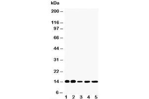 Western blot testing of FABP1 antibody and Lane 1:  rat liver;  2: rat kidney;  3: HeLa;  4: (mouse) Neuro-2a;  5: (human) SMMC-7721 cell lysate (FABP1 (liver) anticorps  (N-Term))