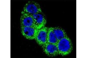 Confocal immunofluorescent analysis of IGF1R antibody with WiDr cells followed by Alexa Fluor 488-conjugated goat anti-rabbit lgG (green).