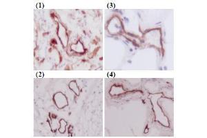 Immunohistochemistry (IHC) image for anti-CD93 (CD93) antibody (ABIN1449221)