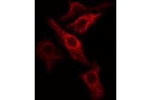 ABIN6274786 staining COLO205 cells by IF/ICC. (PGLS anticorps  (C-Term))