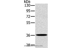 Western blot analysis of A172 cell, using PDLIM1 Polyclonal Antibody at dilution of 1:400 (PDLIM1 anticorps)