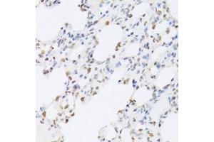 Immunohistochemistry of paraffin-embedded rat lung using SFN Antibody. (14-3-3 sigma/SFN anticorps  (AA 1-248))