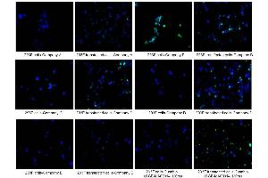 Immunofluorescence staining of 293F cells and 293F transfected cells with Company A, Company B, Company C, Company D, Company E, ABIN7193151 at 1:100, counter-stained with DAPI. (HA-Tag anticorps)