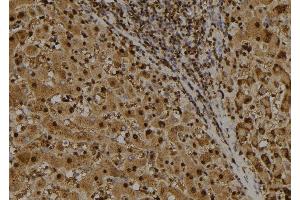 ABIN6277717 at 1/100 staining Human liver tissue by IHC-P. (IRF7 anticorps  (C-Term))